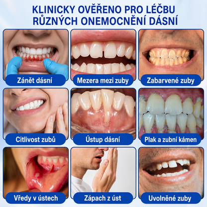 𝐜𝐳) 🦷 𝐏𝐮𝐫𝐚𝐂𝐮𝐫𝐞®  𝐎𝐛𝐧𝐨𝐯𝐚 𝐝á𝐬𝐧í 𝐩𝐚𝐫𝐨𝐝𝐨𝐧𝐭á𝐥𝐧í 𝐨𝐩𝐫𝐚𝐯𝐧ý 𝐠𝐞𝐥