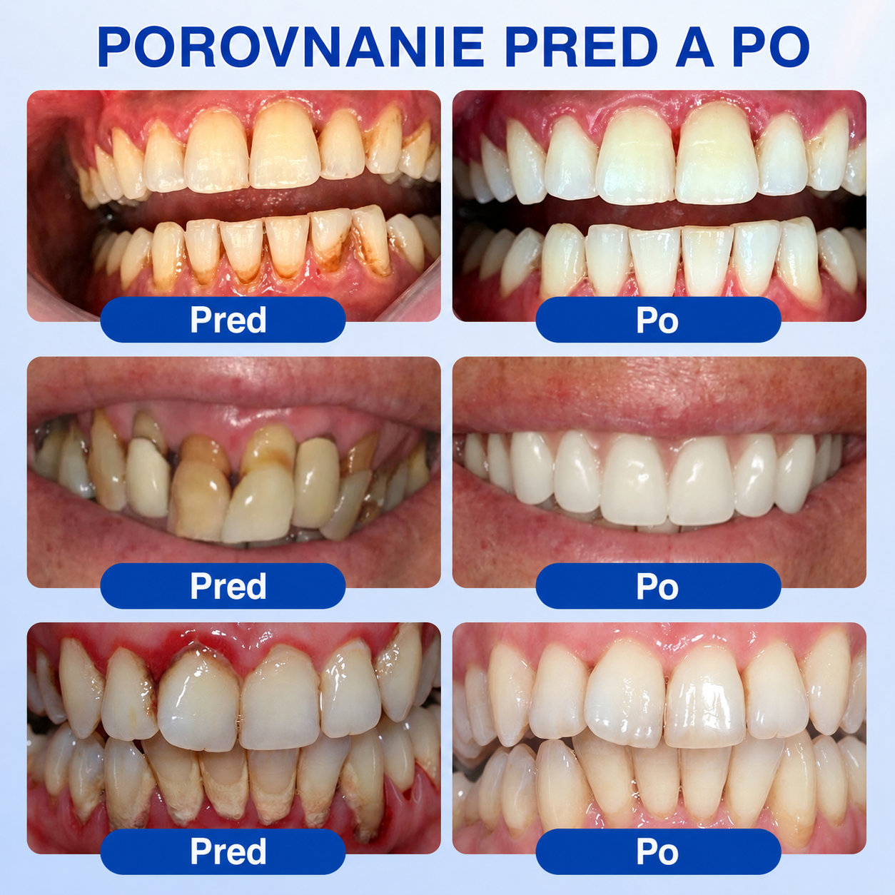 𝒔𝒌)𝑷𝒖𝒓𝒂𝑪𝒖𝒓𝒆® 👨‍⚕️🦷𝑶𝑩𝑵𝑶𝑽𝑨 Ď𝑨𝑺𝑰𝑬𝑵 𝑷𝒂𝒓𝒐𝒅𝒐𝒏𝒕á𝒍𝒏𝒚 𝒐𝒑𝒓𝒂𝒗𝒏ý 𝒈é𝒍🥬