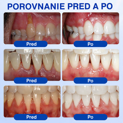 𝒔𝒌)𝑷𝒖𝒓𝒂𝑪𝒖𝒓𝒆® 👨‍⚕️🦷𝑶𝑩𝑵𝑶𝑽𝑨 Ď𝑨𝑺𝑰𝑬𝑵 𝑷𝒂𝒓𝒐𝒅𝒐𝒏𝒕á𝒍𝒏𝒚 𝒐𝒑𝒓𝒂𝒗𝒏ý 𝒈é𝒍🥬