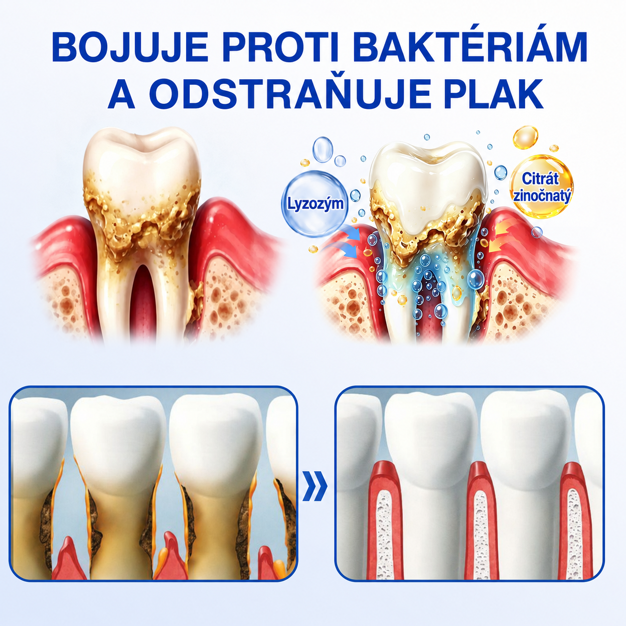 𝒔𝒌)𝑷𝒖𝒓𝒂𝑪𝒖𝒓𝒆® 👨‍⚕️🦷𝑶𝑩𝑵𝑶𝑽𝑨 Ď𝑨𝑺𝑰𝑬𝑵 𝑷𝒂𝒓𝒐𝒅𝒐𝒏𝒕á𝒍𝒏𝒚 𝒐𝒑𝒓𝒂𝒗𝒏ý 𝒈é𝒍🥬