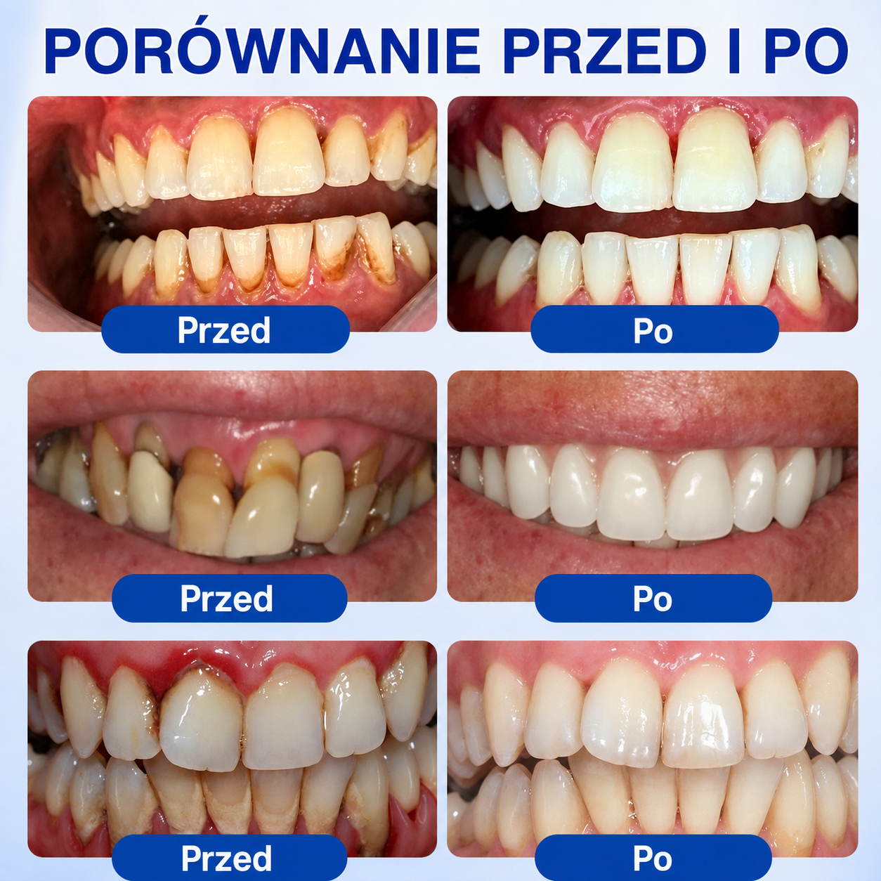 🇵🇱👨‍⚕️✅🦷𝗣𝘂𝗿𝗮𝗖𝘂𝗿𝗲® 𝗢𝗗𝗡𝗢𝗪𝗔 𝗗𝗭𝗜Ą𝗦𝗘Ł Ż𝗲𝗹 𝗻𝗮𝗽𝗿𝗮𝘄𝗰𝘇𝘆 𝗽𝗿𝘇𝘆 𝗽𝗮𝗿𝗮𝗱𝗼𝗻𝘁𝗼𝘇𝗶𝗲🍔