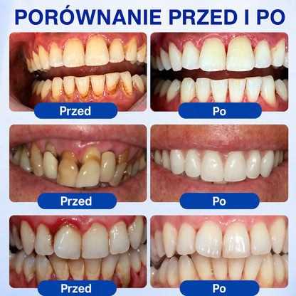 🇵🇱👨‍⚕️✅🦷𝗣𝘂𝗿𝗮𝗖𝘂𝗿𝗲® 𝗢𝗗𝗡𝗢𝗪𝗔 𝗗𝗭𝗜Ą𝗦𝗘Ł Ż𝗲𝗹 𝗻𝗮𝗽𝗿𝗮𝘄𝗰𝘇𝘆 𝗽𝗿𝘇𝘆 𝗽𝗮𝗿𝗮𝗱𝗼𝗻𝘁𝗼𝘇𝗶𝗲🍔
