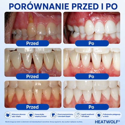 🇵🇱👨‍⚕️✅🦷𝗣𝘂𝗿𝗮𝗖𝘂𝗿𝗲® 𝗢𝗗𝗡𝗢𝗪𝗔 𝗗𝗭𝗜Ą𝗦𝗘Ł Ż𝗲𝗹 𝗻𝗮𝗽𝗿𝗮𝘄𝗰𝘇𝘆 𝗽𝗿𝘇𝘆 𝗽𝗮𝗿𝗮𝗱𝗼𝗻𝘁𝗼𝘇𝗶𝗲🍔