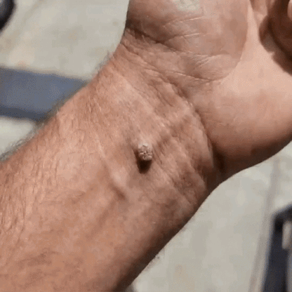 𝐏𝐔𝐑𝐀𝐂𝐔𝐑𝐄® 𝐌𝐈𝐊𝐑𝐎-𝐓Ű𝐒 𝐁𝐎𝐓𝐀𝐍𝐈𝐊𝐀𝐈 𝐁Ő𝐑𝐊𝐈𝐍Ö𝐕É𝐒-𝐄𝐋𝐓Á𝐕𝐎𝐋Í𝐓Ó 𝐓𝐀𝐏𝐀𝐒𝐙𝐎𝐊 —5 𝐍𝐀𝐏𝐎𝐒 𝐂É𝐋𝐙𝐎𝐓𝐓 𝐄𝐋𝐓Á𝐕𝐎𝐋Í𝐓Á𝐒 𝐁Ő𝐑𝐍𝐘Ú𝐋𝐕Á𝐍𝐘𝐎𝐊, 𝐒𝐙𝐄𝐌Ö𝐋𝐂𝐒Ö𝐊 É𝐒 𝐊𝐈𝐄𝐌𝐄𝐋𝐊𝐄𝐃Ő 𝐁Ő𝐑𝐇𝐈𝐁Á𝐊 𝐄𝐋𝐋𝐄𝐍