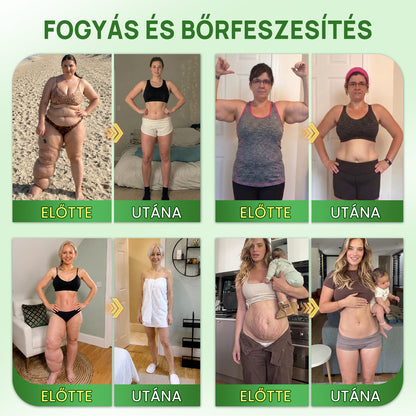 Hivatalos Áruház | Újdonság! 🍀 BSWELL® Moringa × Berberin × NAD+ 10 az 1-ben Nano Mikrotűs Tapasz (Naponta egyszer, látható változások 7 nap után) Berberin + Moringa Formula ✅ Elhízás, megereszkedett bőr, cukorbetegség, alvási apnoé, ízületi problémák
